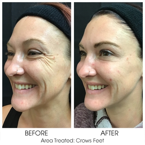 Before + After Gallery: Face