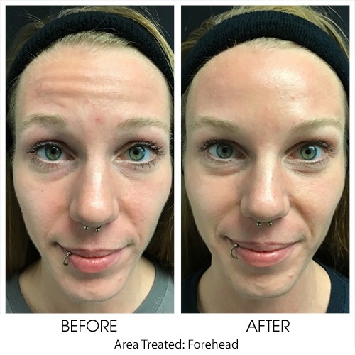 Before + After Gallery: Face