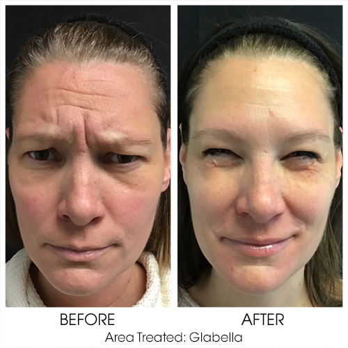 Before + After Gallery: Face