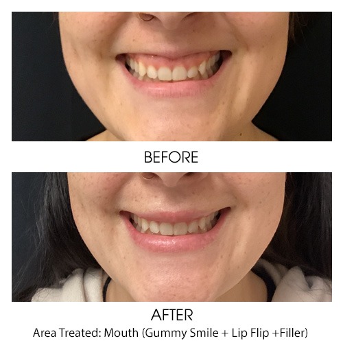 Before + After Gallery: Face