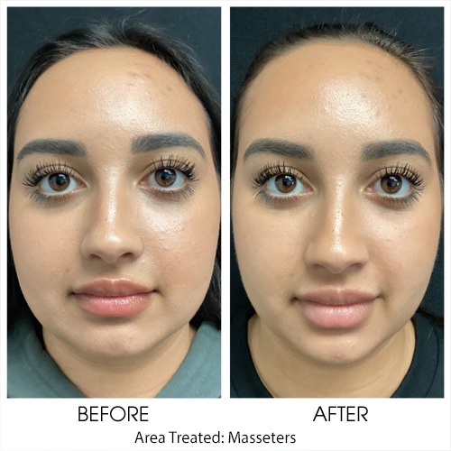 Before + After Gallery: Face