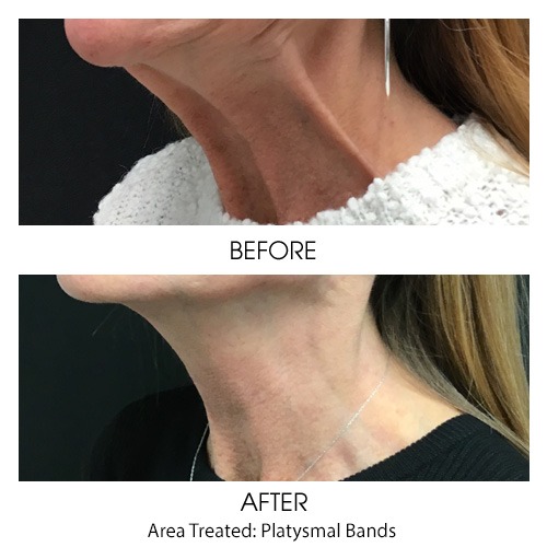 Before + After Gallery: Face
