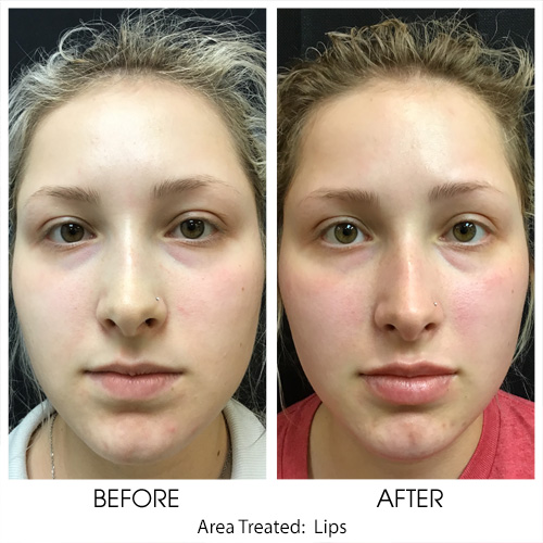 Before + After Gallery: Face