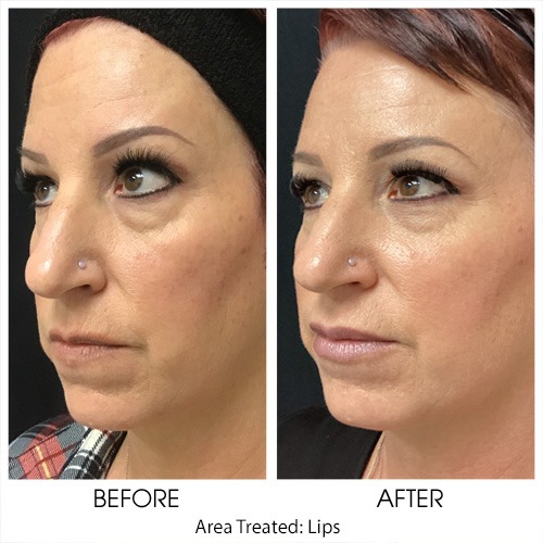 Before + After Gallery: Face