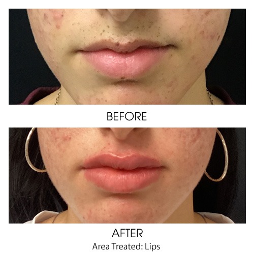 Before + After Gallery: Face