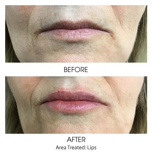 Before + After Gallery: Face