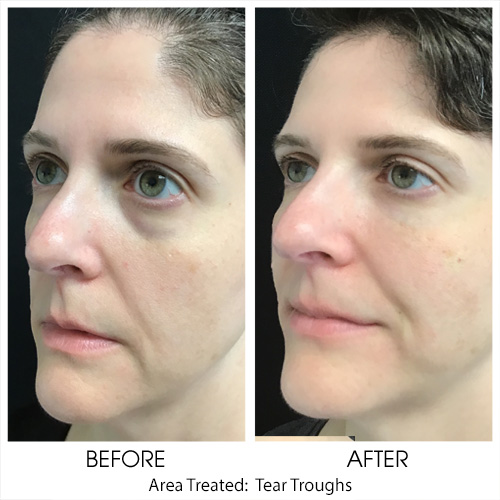 Before + After Gallery: Face