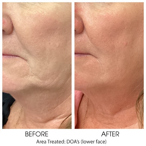 Before + After Gallery: Face