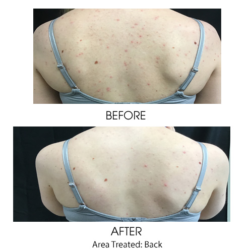 Before + After Gallery: Face