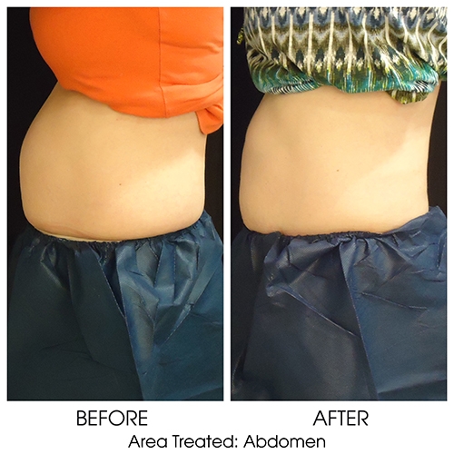 Before + After Gallery: Body