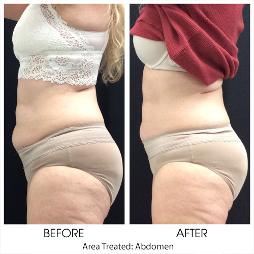 Before + After Gallery: Body