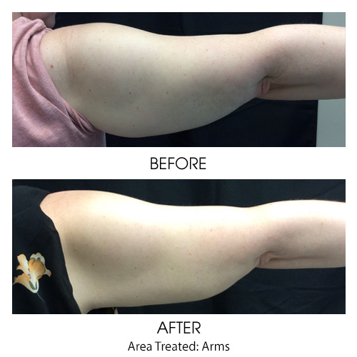 Before + After Gallery: Body