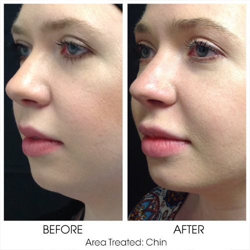 Before + After Gallery: Body