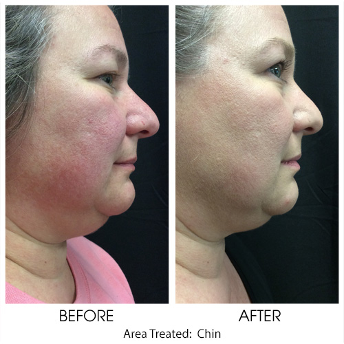 Before + After Gallery: Body