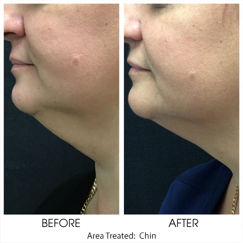 Before + After Gallery: Body