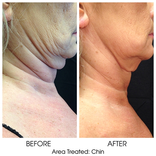 Before + After Gallery: Body