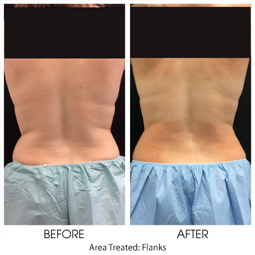 Before + After Gallery: Body