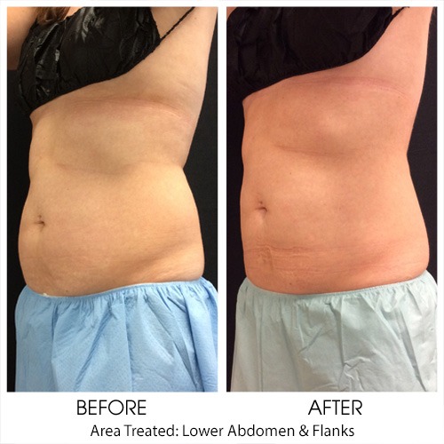 Before + After Gallery: Body