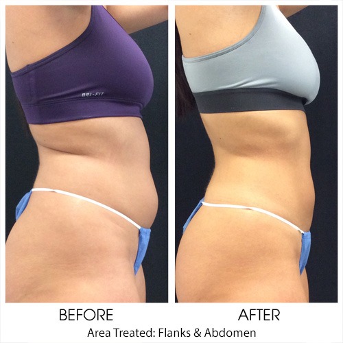 Before + After Gallery: Body