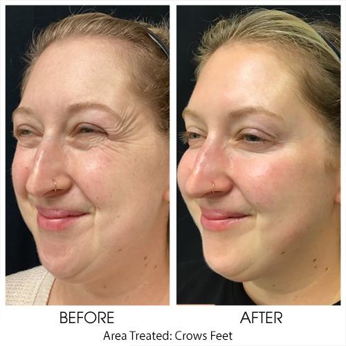 Before + After Gallery: Face
