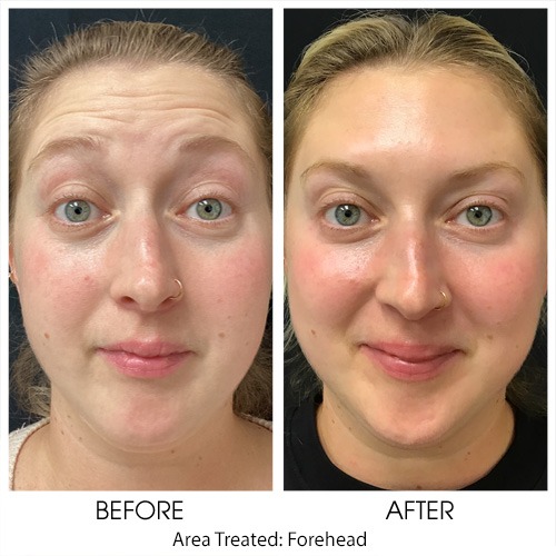 Before + After Gallery: Face