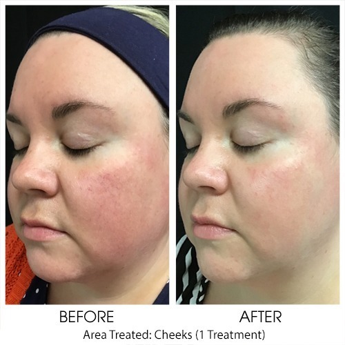 Before + After Gallery: Face
