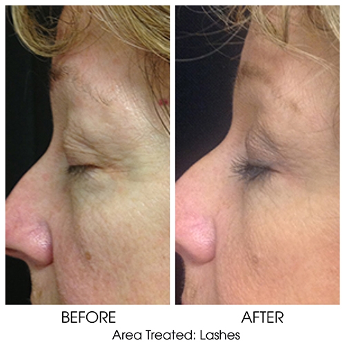 Before + After Gallery: Face