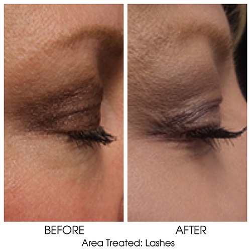 Before + After Gallery: Face