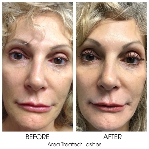 Before + After Gallery: Face