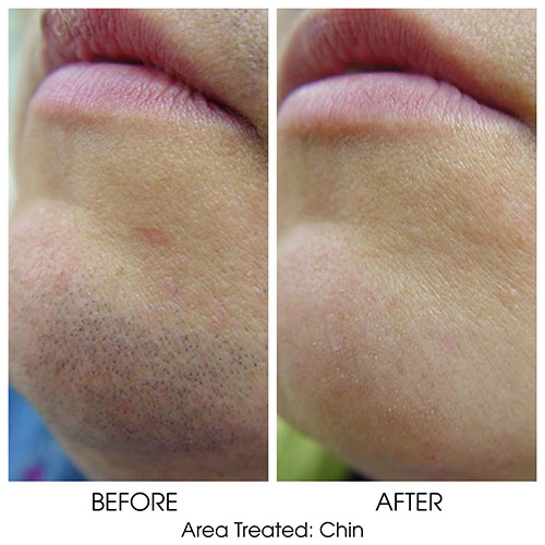Before + After Gallery: Face