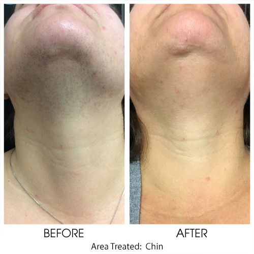 Before + After Gallery: Body