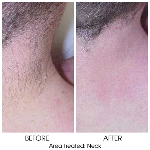 Before + After Gallery: Face