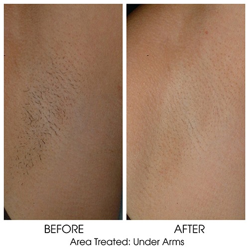 Before + After Gallery: Face