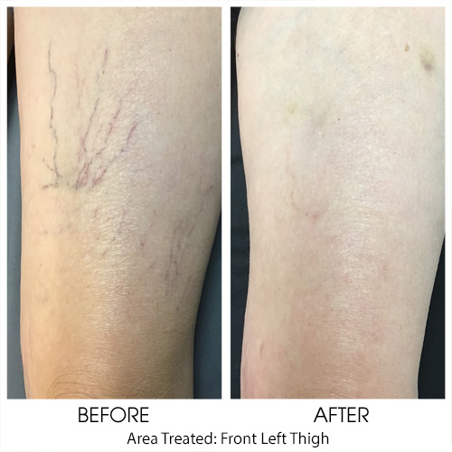 Before + After Gallery: Body