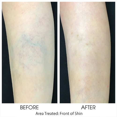 Before + After Gallery: Body