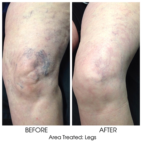 Before + After Gallery: Body