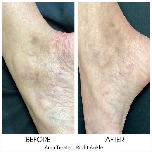 Before + After Gallery: Body