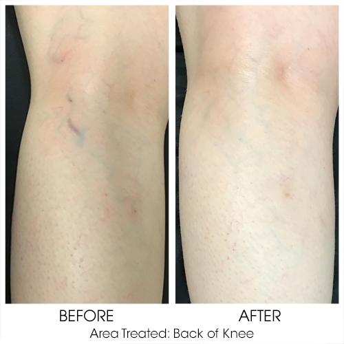 Before + After Gallery: Body