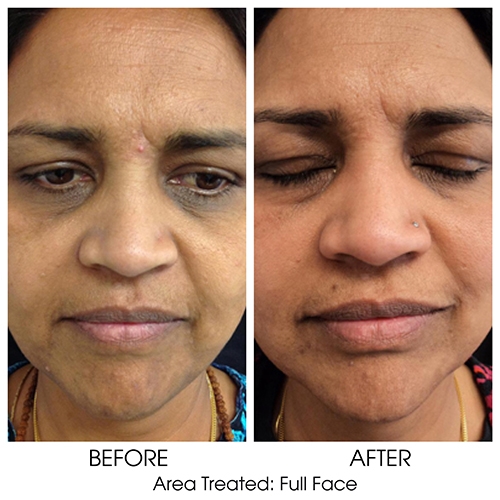 Before + After Gallery: Face
