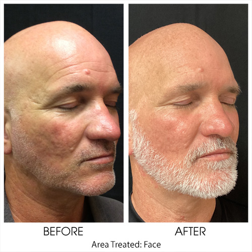 Before + After Gallery: Face