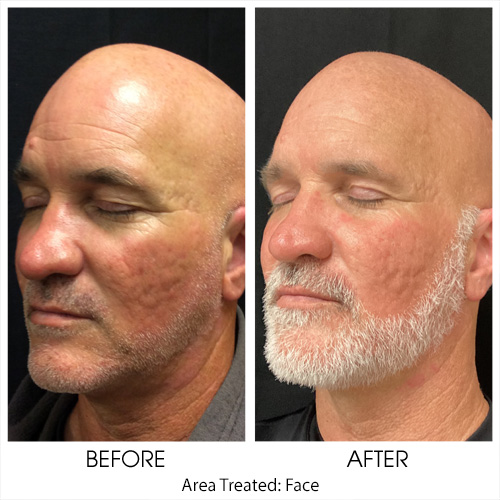 Before + After Gallery: Face