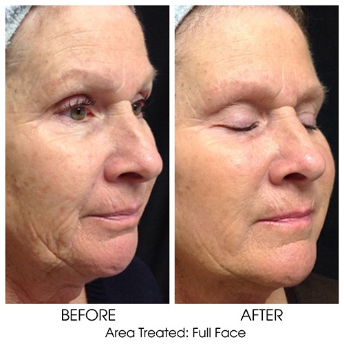 Before + After Gallery: Face