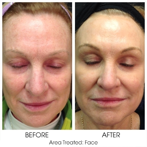 Before + After Gallery: Face