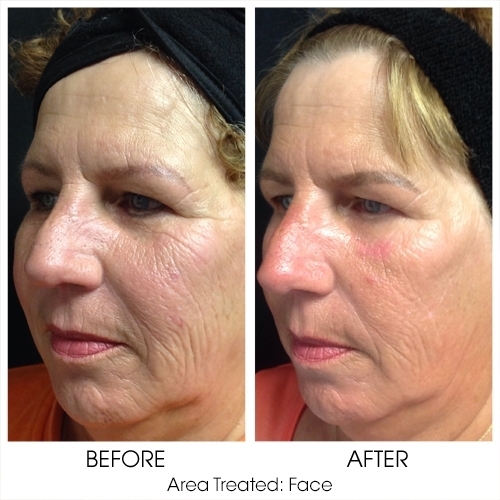 Before + After Gallery: Face