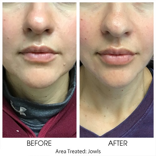 Before + After Gallery: Face