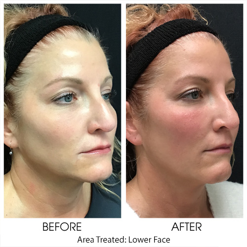 Before + After Gallery: Face