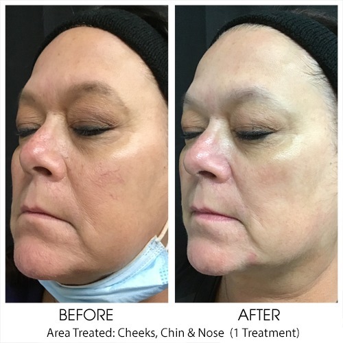 Before + After Gallery: Face
