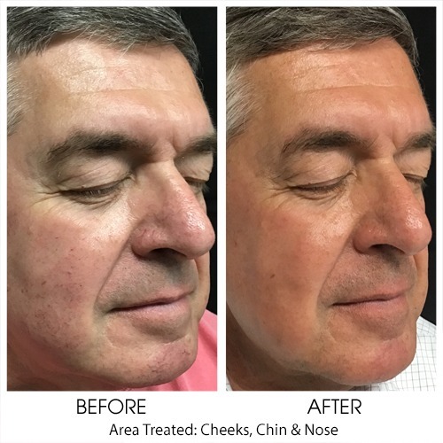 Before + After Gallery: Face
