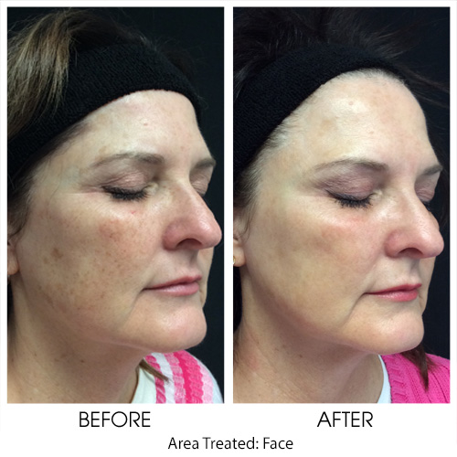 Before + After Gallery: Face