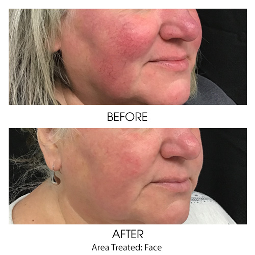 Before + After Gallery: Face